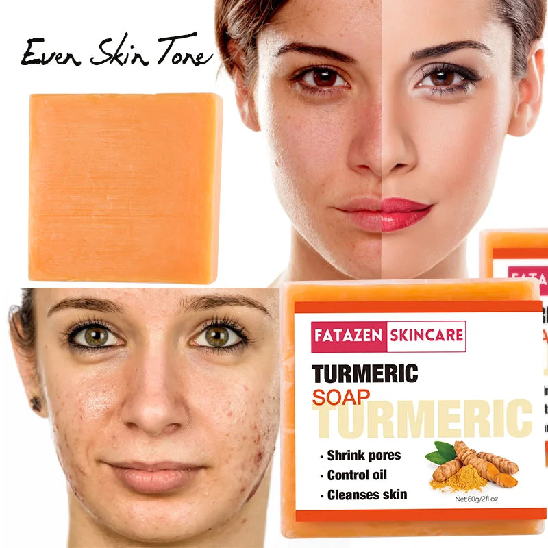 Natural Organic Deep Cleansing Bath Toilet Soaps Handmade Skin Care Products Whitening Anti Acne Turmeric Bar Soap