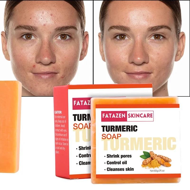 Natural Organic Deep Cleansing Bath Toilet Soaps Handmade Skin Care Products Whitening Anti Acne Turmeric Bar Soap