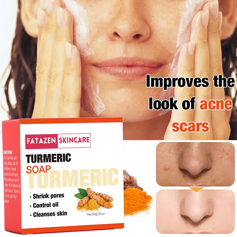 Natural Organic Deep Cleansing Bath Toilet Soaps Handmade Skin Care Products Whitening Anti Acne Turmeric Bar Soap